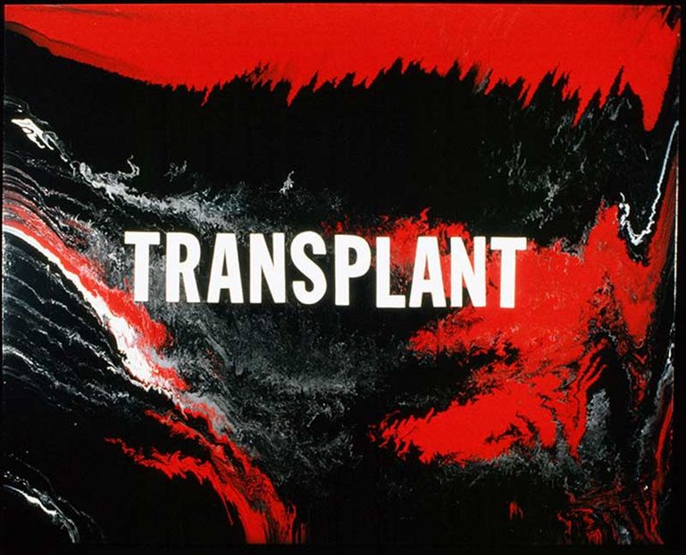 Phillips transplant