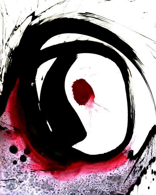 Eye I