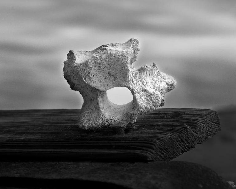 Vertebra