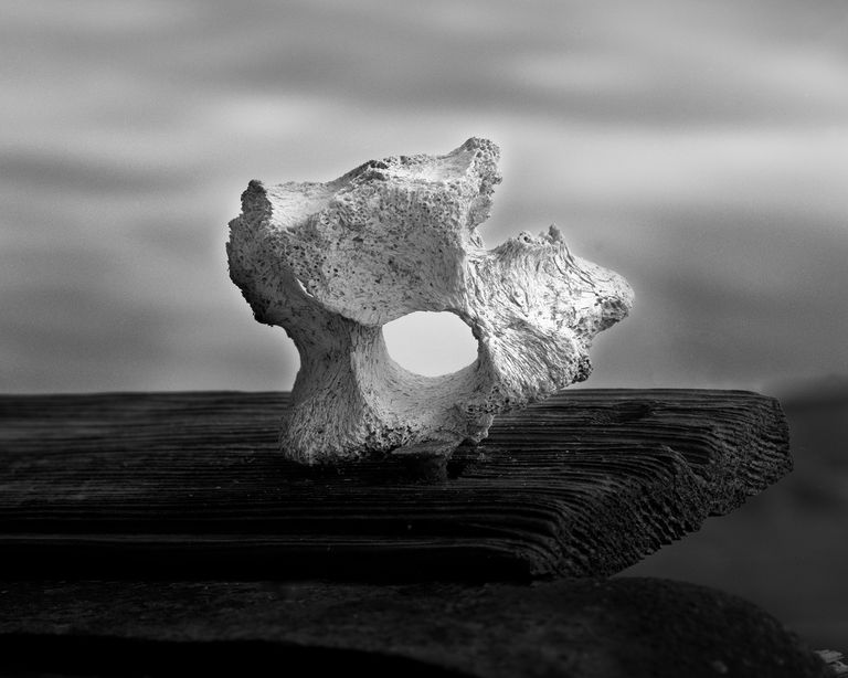 Vertebra