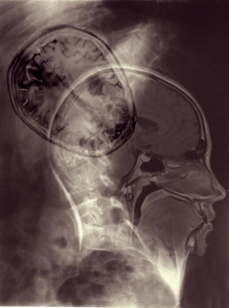 Brain spine connection 1