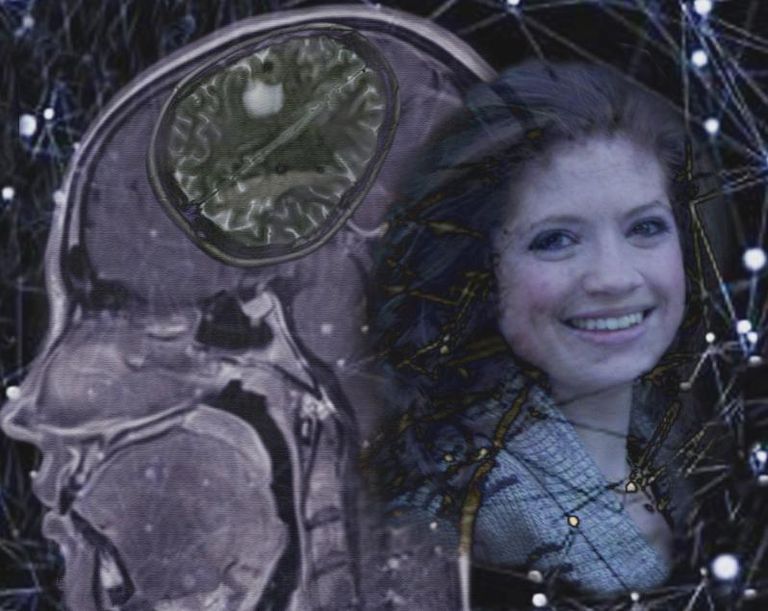 Kendell brain 1