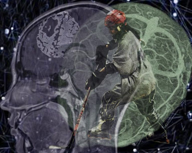 Kendell brain 4