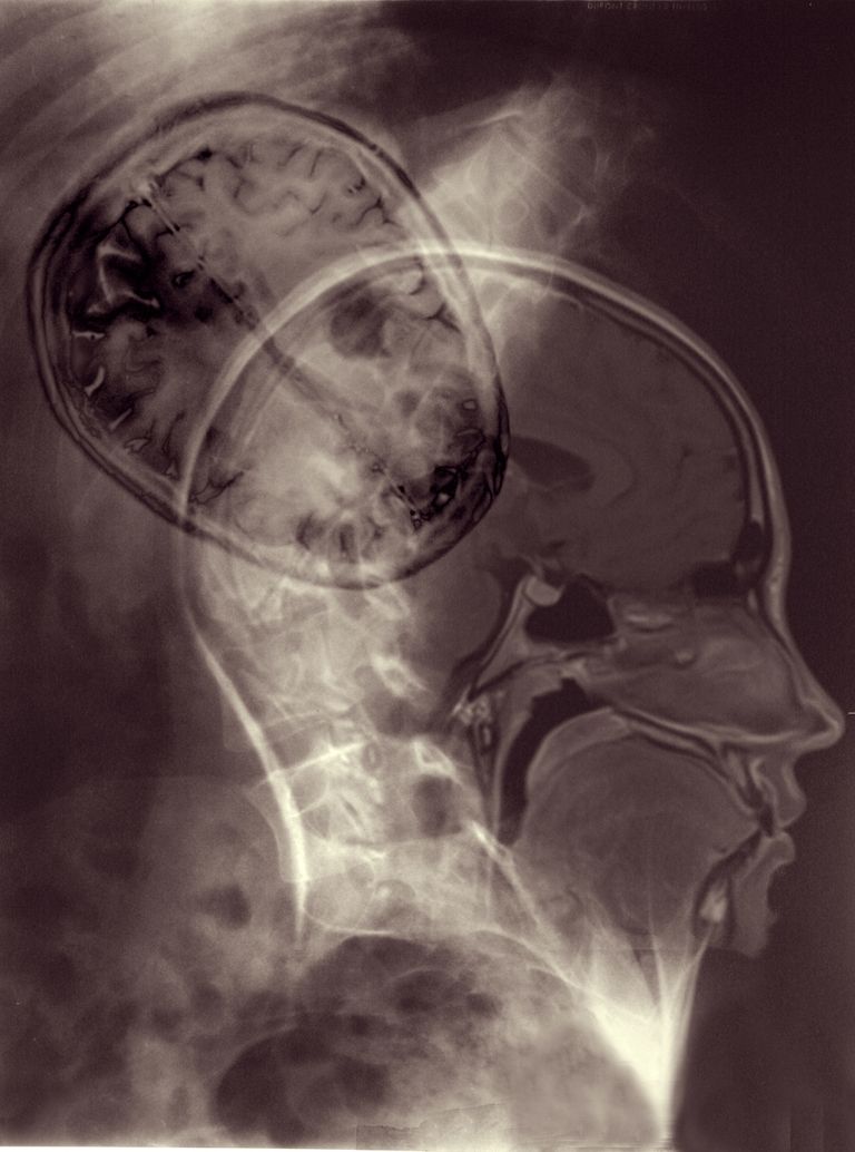 Brain Spine Connection 1