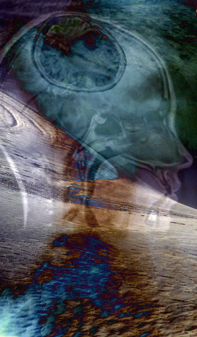 Brain Spine Connection 2