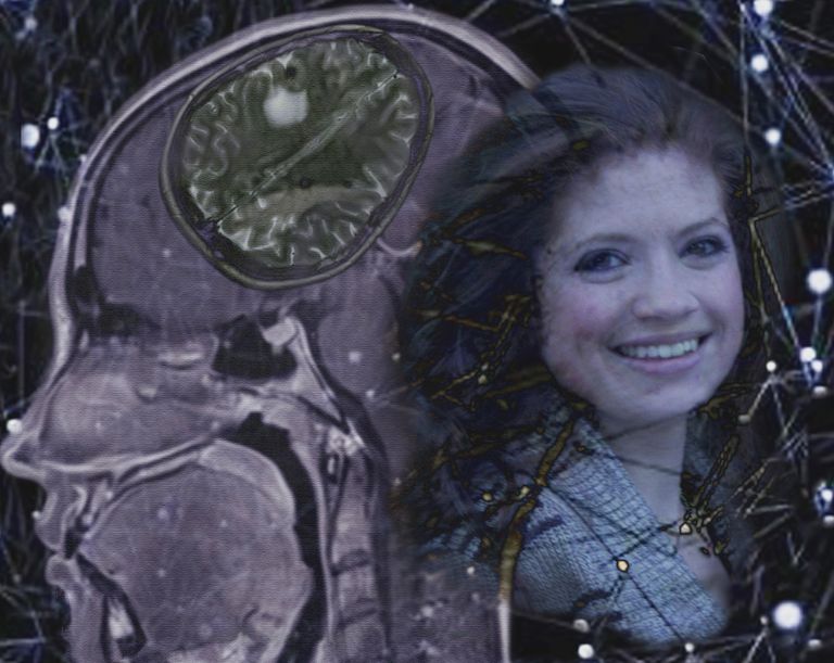 Kendell Brain 1